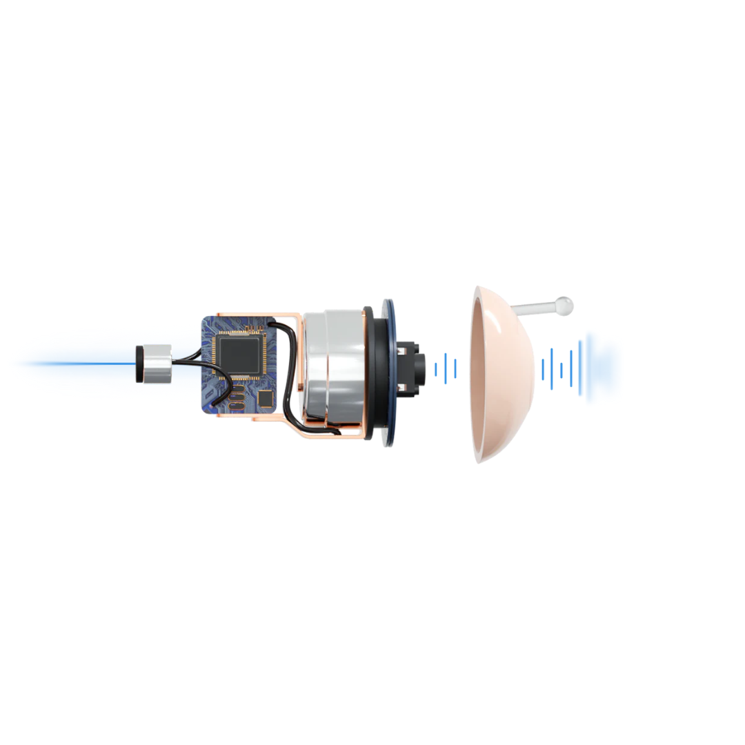A digital illustration of a bionic eye implant reveals its inner workings, with signals emitted toward a human eye—similar to how Audien Hearing Atom X Hearing Aids with Digital Case Control provide innovative, accessible sensory enhancement.