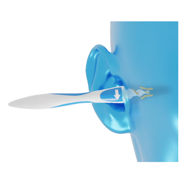 A blue model head shows a cotton swab pushing earwax deeper, unlike the Audien Ear Cleaning Kit with 16 reusable cleaning attachments designed for safe, effective ear care; an arrow on the swab indicates its direction.