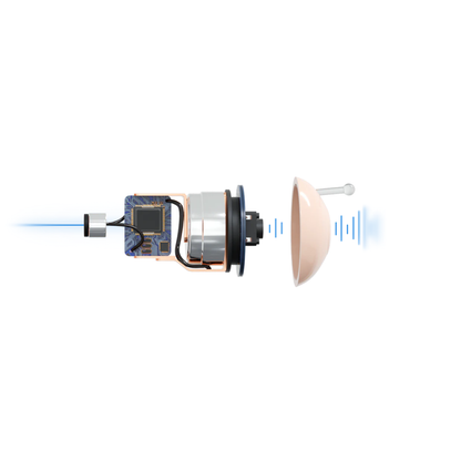 A digital illustration of a bionic eye implant reveals its inner workings, with signals emitted toward a human eye—similar to how Audien Hearing Atom X Hearing Aids with Digital Case Control provide innovative, accessible sensory enhancement.