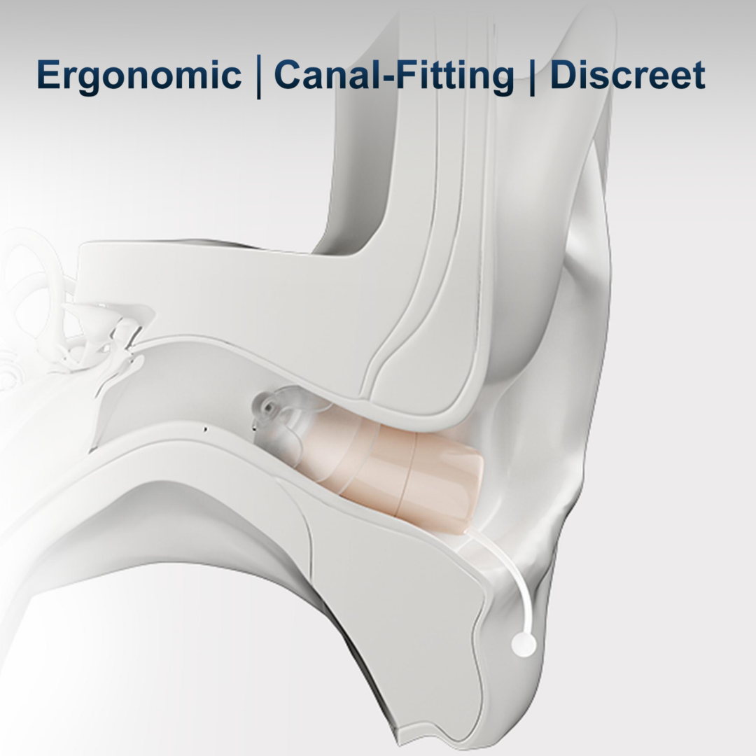 A cross-section illustration of an ear shows a Ceretone Core One Pro Hearing Aid - Invisible-In-Canal placed discreetly in the canal. At the top, text reads “Ergonomic | Canal-Fitting | Discreet.”.