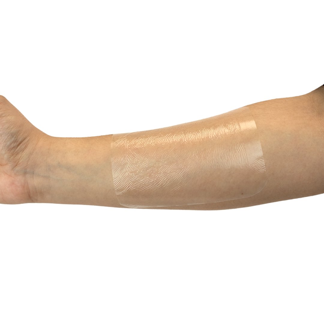 A forearm covered with a Dynarex Transparent Film Dressing Frame Style, a large rectangular bandage that securely protects the skin while allowing visibility of the wound beneath.