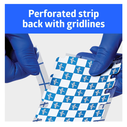 A person wearing blue gloves peels a perforated strip with gridlines from a sheet of Medline MedGel EKG/ECG Resting Tab Electrodes. Text above reads: Perforated strip back with gridlines.