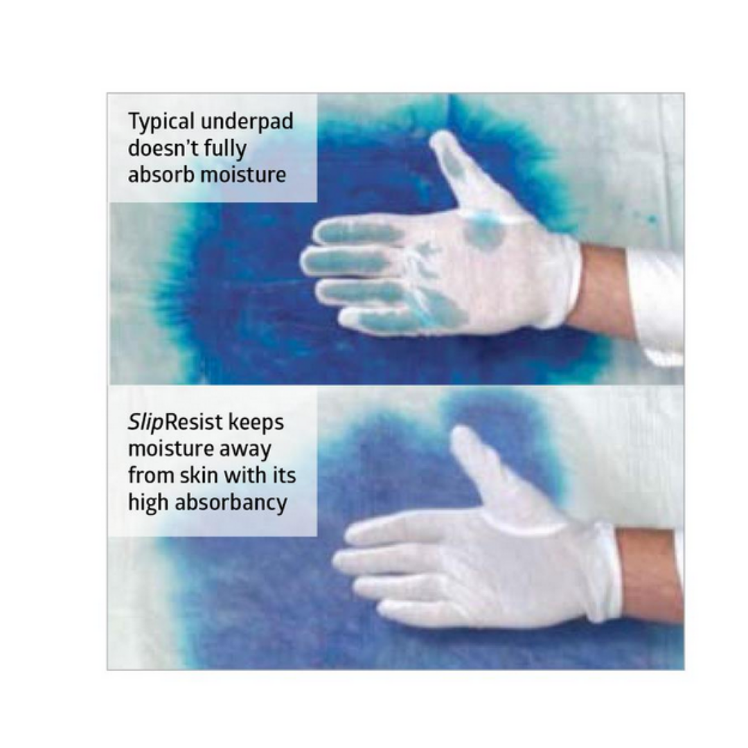 Two images compare absorbency: Top shows a gloved hand on a wet, blue-stained pad labeled typical underpad. Bottom shows a dry glove on Medline Ultrasorbs Advanced Premium Underpads with SlipResist Technology for better incontinence management.